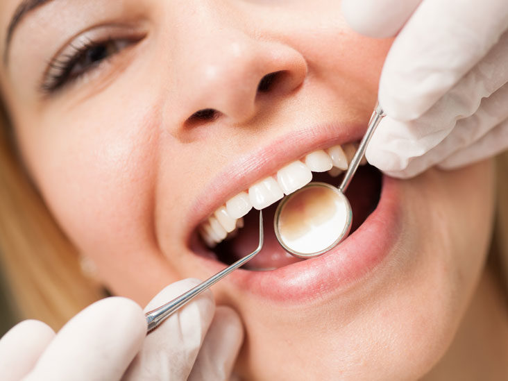 dental-oral-health-what-happens-antoniosofan